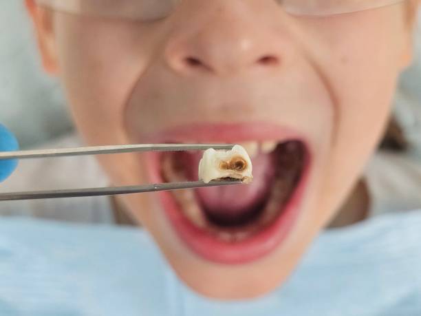 Best Emergency Denture Repair in Milam, TX